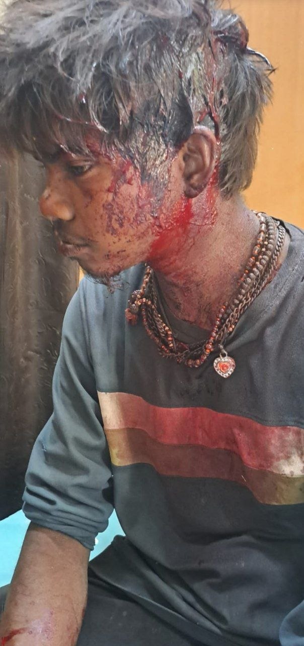 कातकरी समाजातील मुलावर कोयत्याने हल्ला दुचाकीवरून आलेल्या दोघांनी मारल्याची शक्यता; कणकवली शहरातील घटना